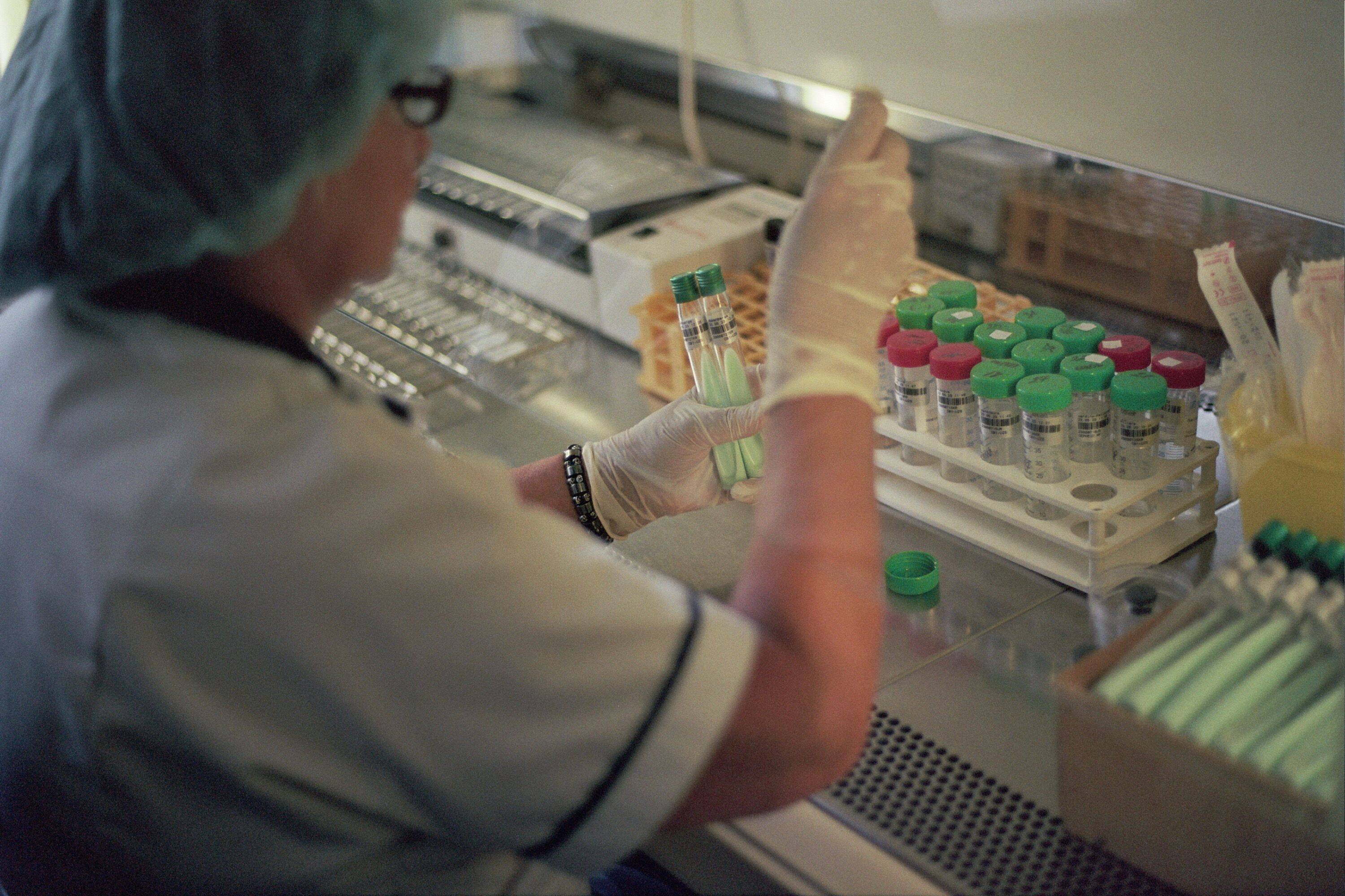 Eine Frau sitzt an einem Laborplatz und hat eine Pipette in der Hand. Sie führt einen Tuberkulosetest durch